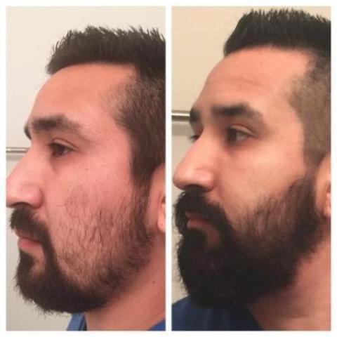 BERCHI™ - Organic Hair Growth Essence