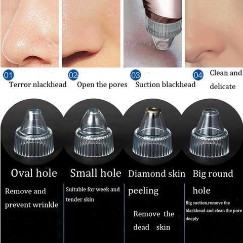 Extraspire - The Blackhead Suction Extractor
