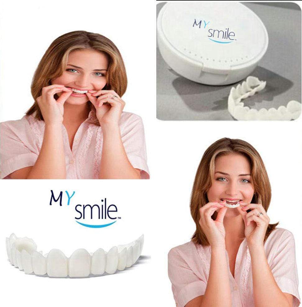 MYSMILE™: Revolutionary Veneer for an Attractive Smile