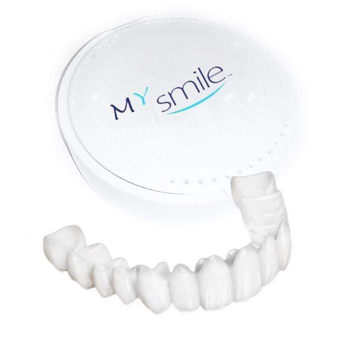 MYSMILE™: Revolutionary Veneer for an Attractive Smile