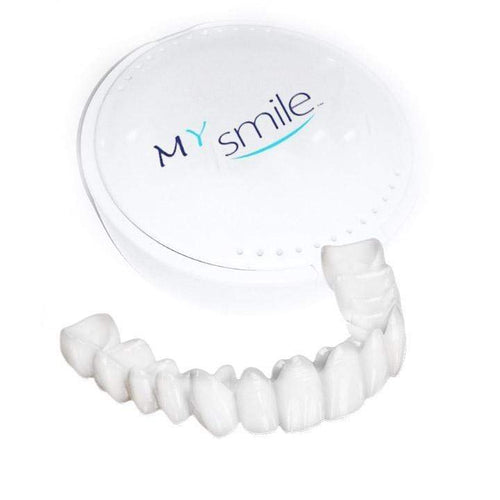 MYSMILE™: Revolutionary Veneer for an Attractive Smile