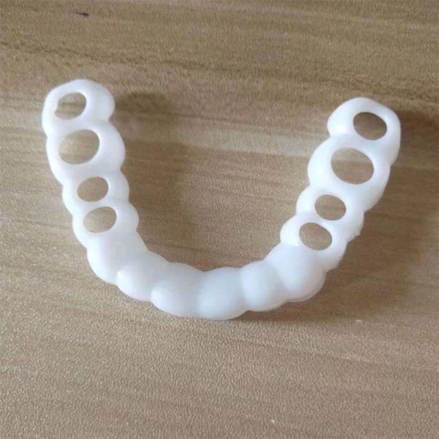 MYSMILE™: Revolutionary Veneer for an Attractive Smile