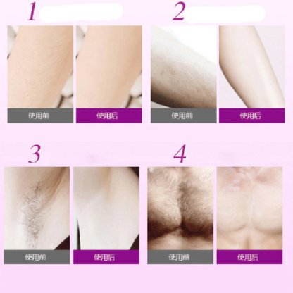 SPRAYEPIL™: Pain-Free Hair Removal Spray - 100% Effective and Natural