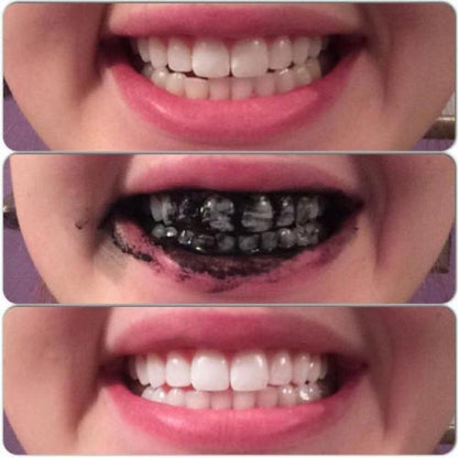 Ultrawhite™ - Natural & Organic BAMBOO Whitening Toothpaste